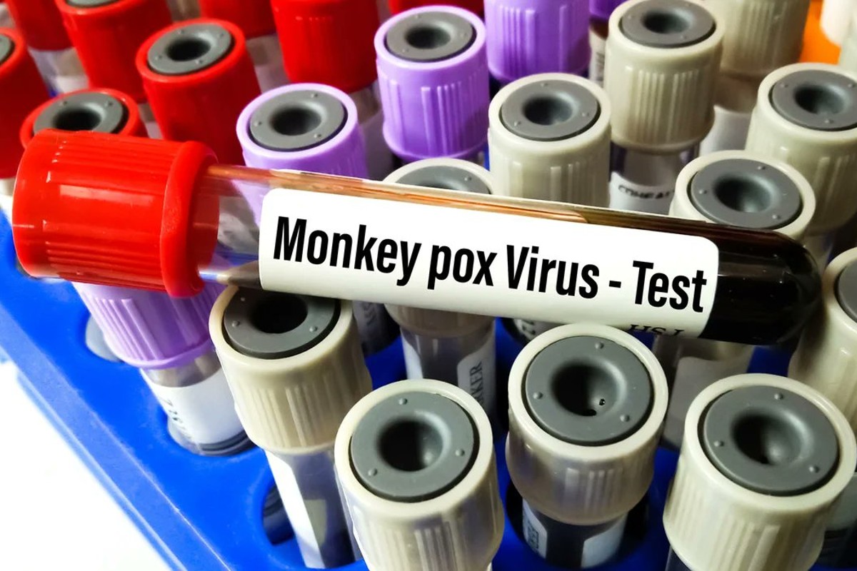 viruela-mono-oms-contagios 1